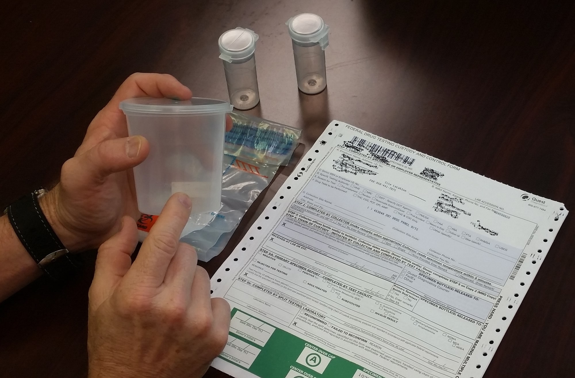 Urine specimen collection